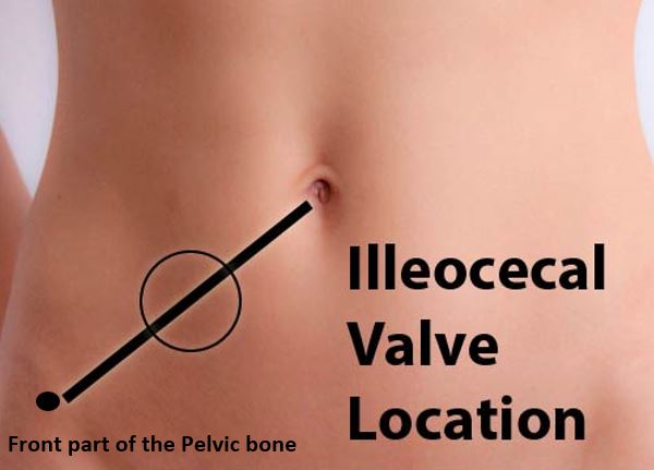 Ileocecal valve location